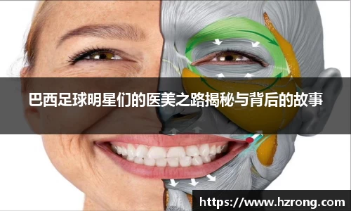 巴西足球明星们的医美之路揭秘与背后的故事